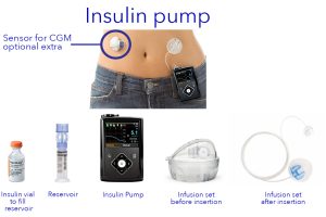 pumps_Medtronic_insulin-pump-components